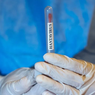 CDC: Virus Andes Satu-satunya Hantavirus yang Bisa Menular Antar-Manusia