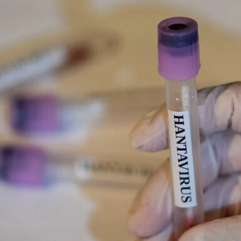 4 ABK yang Berlayar ke Somalia Sempat Suspek Hantavirus, Hasil Pemeriksaan Negatif
