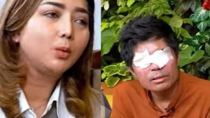 Agus Salim, seorang korban penyiraman air keras, melaporkan YouTuber Novi ke polisi, karena uang donasi senilai Rp1,5 miliar.