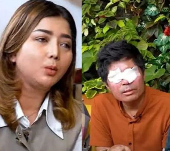 Agus Salim, seorang korban penyiraman air keras, melaporkan YouTuber Novi ke polisi, karena uang donasi senilai Rp1,5 miliar. <b>(Instagram)</b>