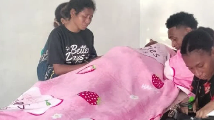 Mina Puadi (51 th) warga Biak, yang terluka akibat ledakan bom peninggalan PD II, Selasa dini hari (2/6) meninggal di RSUD Biak. ANTARA/HO/Humas Polda Papua